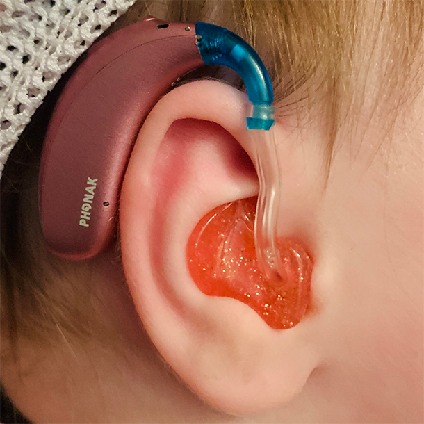 Hearing Aid for Kids – Abid Hearing Care Center Providing children with the right hearing support is essential for their speech, language, and overall development. At Abid Hearing Care Center, we specialize in hearing aids for kids in Bangladesh, offering advanced, child-friendly devices that are safe, comfortable, and effective. Our goal is to help children with hearing challenges participate fully in school, social activities, and family life. Importance of Hearing Aids for Kids Early detection and intervention are critical for children with hearing loss. Hearing difficulties in infants and young children can affect speech, learning, and social skills. Using a hearing aid tailored for children ensures that they can hear clearly, develop language skills naturally, and stay on track with their peers. By providing professional hearing assessments, we identify the specific needs of each child and recommend the most suitable device. Features of Kids’ Hearing Aids Our hearing aids for kids are designed to be lightweight, durable, and easy to use. Many models include digital sound processing for clearer speech and background noise reduction, which is essential in classrooms and busy environments. Rechargeable batteries, customizable settings, and comfortable ear molds make these devices suitable for long hours of use. Additionally, our devices are visually appealing, encouraging children to wear them consistently. Services at Abid Hearing Care Center At Abid Hearing Care Center, we provide comprehensive support for children and their families. Our audiologists perform professional hearing assessments, guide parents in choosing the right device, and provide ongoing follow-up to ensure optimal performance. We also educate parents on proper usage, maintenance, and troubleshooting so that the child receives the full benefit of their hearing aid. Benefits of Early Intervention Providing children with hearing aids early leads to improved communication skills, better learning outcomes, and enhanced social confidence. Parents gain peace of mind knowing their child can hear clearly, while children can fully participate in educational and social activities. Investing in a hearing aid for kids at Abid Hearing Care Center ensures that your child receives the best possible care, helping them develop speech, language, and confidence from an early age.